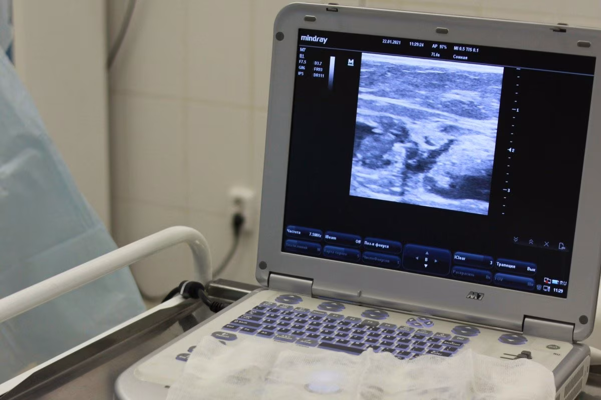 Mindray ultrasound machine displaying liver fibrosis scan from Stockmark.it